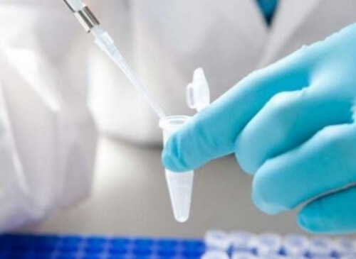 Gehirntumore mittels Flüssigbiopsie frühzeitig entdecken