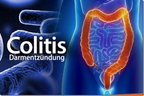 6 Rezepte für einen gesunden Darm