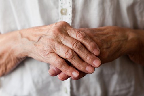 8 natürliche Mittel zur Linderung der Arthritis in Händen und Handgelenken