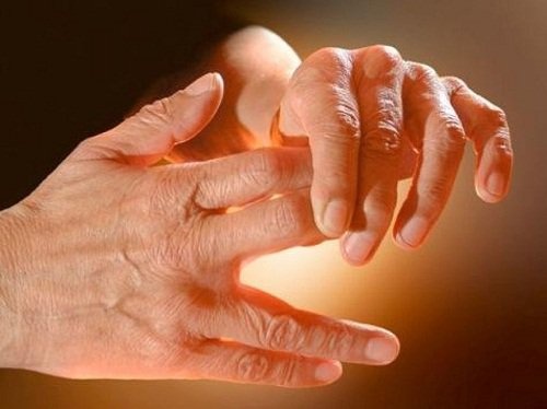 Schmerzen-Hand