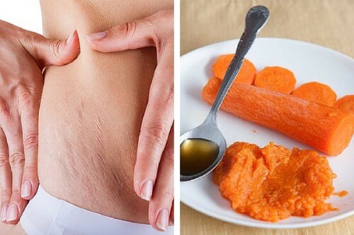 Mit Karotten gegen Schwangerschaftsstreifen? Leider nicht!