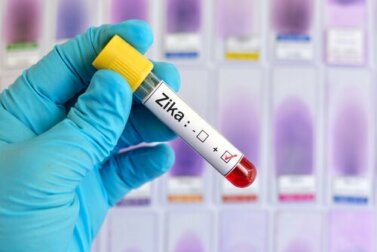 Zika-Virus und was du wirklich darüber wissen solltest