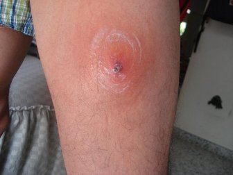 Flohbisse: Vorsorge und Behandlung