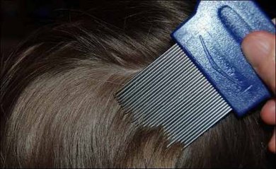 Was tun bei Kopflausbefall? 10 Tipps