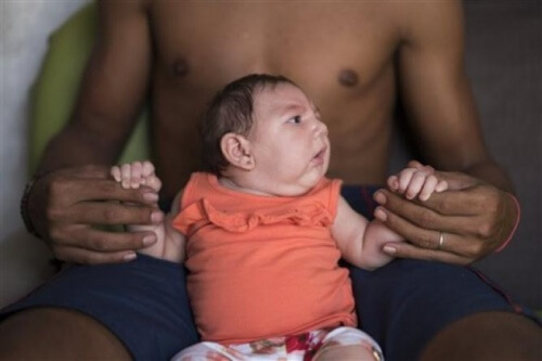 Mikrozephalie durch Zika-Virus verursacht