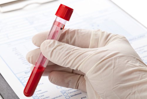 Reagenzrohr für Bluttest