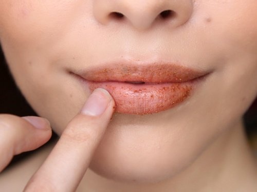 Zimt für vollere Lippen