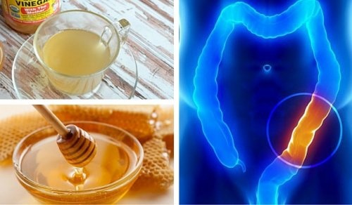 Hausmittel Zur Darmreinigung Mit Nur 2 Zutaten Besser Gesund Leben