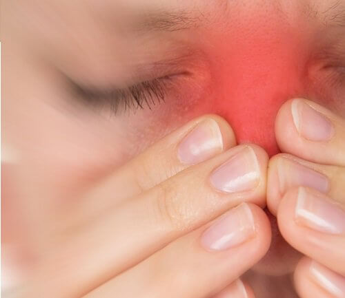 Sinusitis behandeln