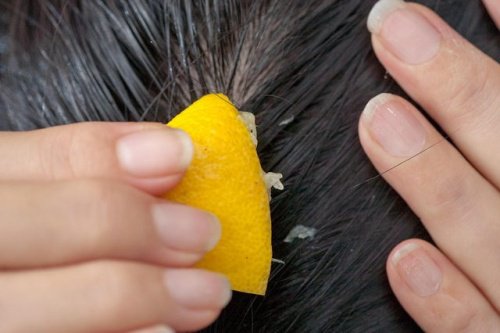Wie sich mit Zitronensaft Haarausfall vorbeugen lässt