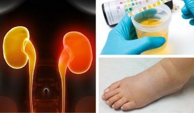 8 entscheidende Anzeichen für Niereninsuffizienz, die oft ignoriert werden