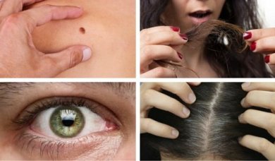 8 Anzeichen, die auf ein Gesundheitsproblem hinweisen könnten