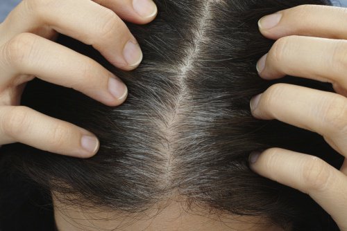 Haare