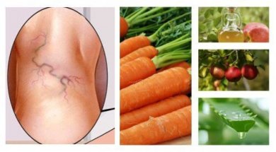 Hausmittel gegen Krampfadern mit Aloe, Karotten und Apfelessig
