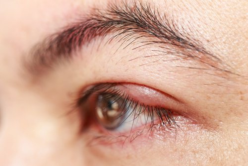 Rizinusöl für gesunde Augen