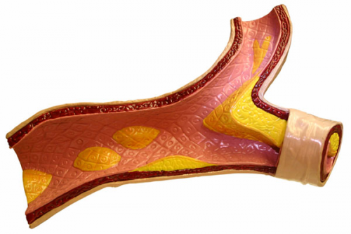 Cholesterinwerte