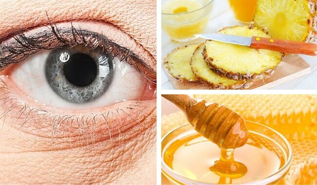 Ananas-Maske zur Verminderung von Augenfältchen
