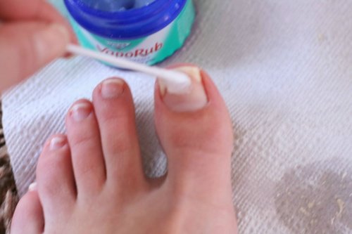 Wick-Vaporub-Nägel
