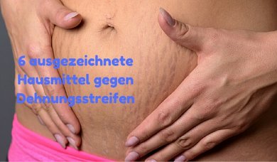 6 ausgezeichnete Hausmittel gegen Dehnungsstreifen