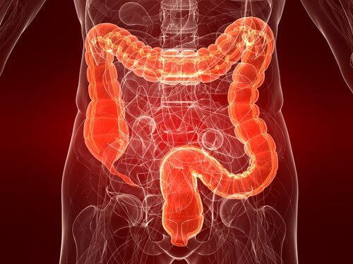 Colitis ulcerosa: eine noch unerforschte Darmerkrankung Colitis ulcerosa: eine noch unerforschte Darmerkrankung