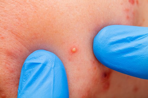 Hauterkrankungen diagnostizieren