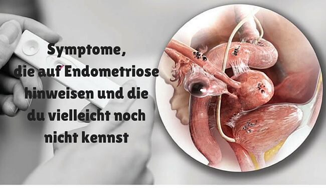 7 relativ unbekannte Symptome von Endometriose