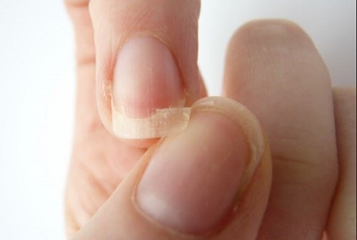 Tipps für gepflegte und kräftige Fingernägel