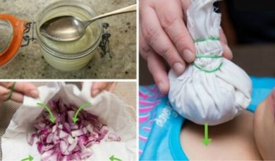 Zwiebel: 12 alternative Verwendungsmöglichkeiten