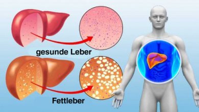 10 Nahrungsmittel zur Reinigung der Leber