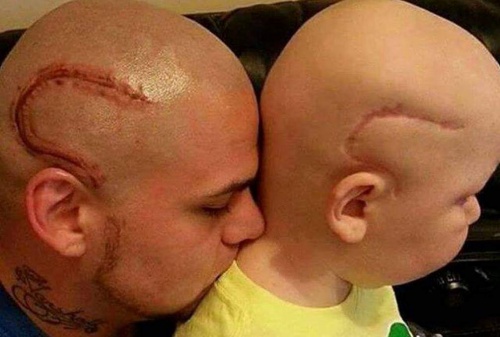 Vater lässt sich Krebsnarbe seines Sohnes tätowieren