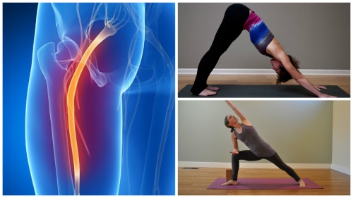 Mit Yoga gegen Ischias-Schmerz