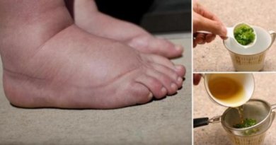 Ausgezeichnetes Hausmittel gegen geschwollene Füße