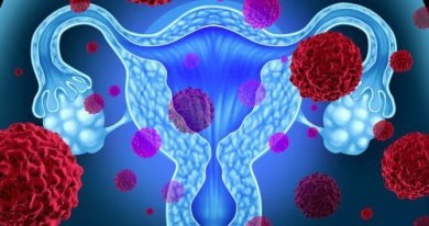 Vorsicht: Toxisches Schocksyndrom durch Tampons