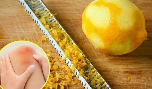 Zitronenschale könnte gegen Gelenkschmerzen helfen
