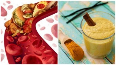 5 ausgezeichnete Hausmittel, die zur Reinigung der Arterien beitragen könnte