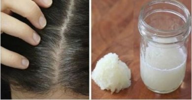 Hausmittel mit Zwiebel und Honig gegen Haarausfall