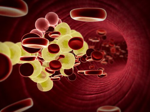 olivenoel-mit-zitrone-gegen-hohes-cholesterin
