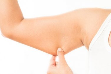 5 Tipps für straffe Arme