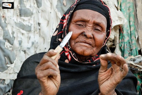 afrikanische-frau-genitalverstuemmelung