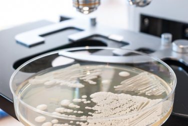 10 Nahrungsmittel, die bei einer Candida-Infektion helfen könnten