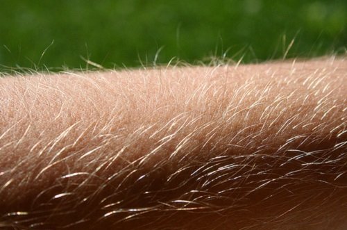 Süßer Schmerz Intimhaare Weglasern Süßer Schmerz Intimhaare Weglasern