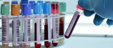 Bluttest weist Depression nach