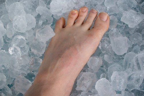 Überbein mit Eis behandeln