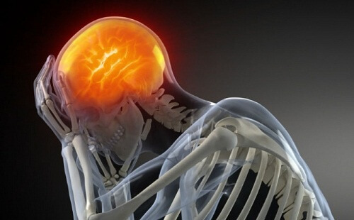 Wann uns Kopfschmerzen Sorgen machen sollten