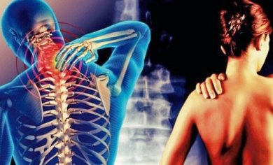 Cervicobrachialgie: das Arm-Schulter-Symptom