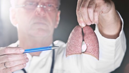 arzt-zeigt-lunge-und-folgen-von-rauchen