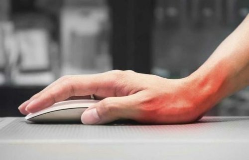 sehnenscheidenentzuendung-durch-computerarbeit
