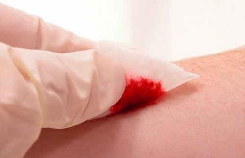 behandlung-von-wunden-honig