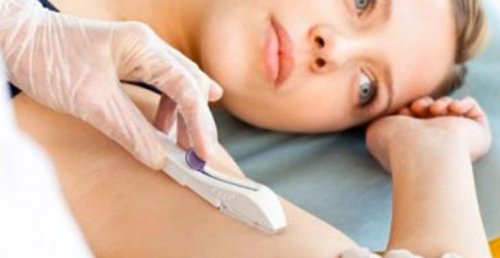 Wissenswertes Rund Um Das Verhutungsstabchen Besser Gesund Leben