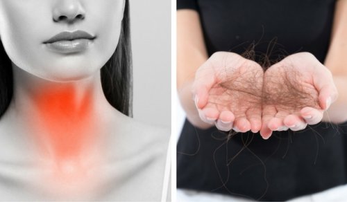 8 Tipps gegen Haarausfall durch eine Schilddrüsenstörung